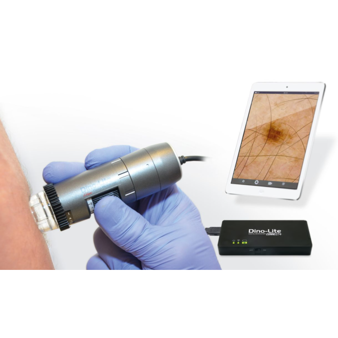 Video Dermatoscop USB pentru dermatoscopie computerizata
